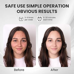 Color Light Face Mask - Skincare Therapy at Home