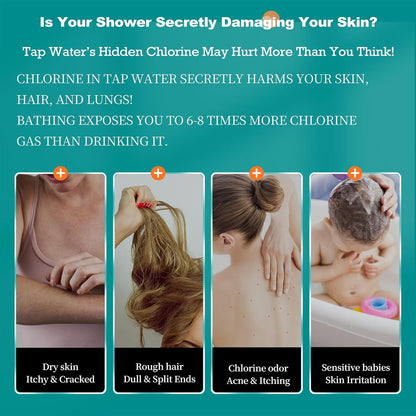 SGS Filtered High Pressure Shower Head | Removes Chlorine, For Hard Water & Hair Loss | 3 Modes with Adj. Flow Pause | Double Sided Micro-Nano Bubble Tech, (Starter Kit - Rose